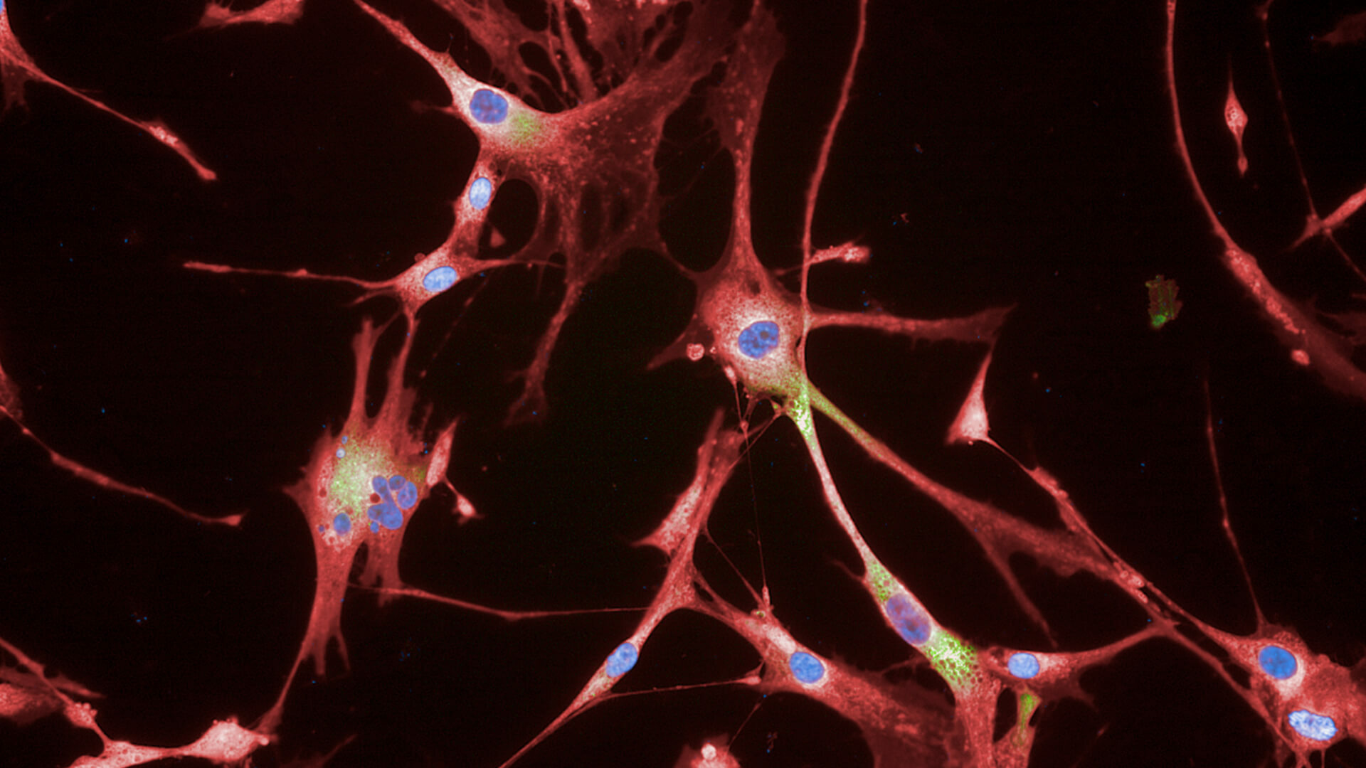 Photo of Rejuvenated Senescent Fibroblasts background